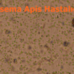 nosema apis hastaligi