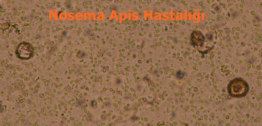 nosema apis hastaligi